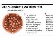 terapia génica podría mejorar síntomas Parkinson