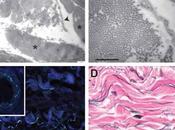 Noticias Médicas: Intersticio, Descubrimiento Nuevo Órgano"
