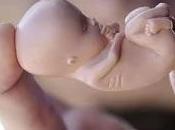 derecho abortar