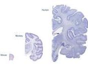 Descifran Misterio Cerebro Causante Problemas Cognitivos