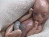 Bebé nacido muerto meses, minutos después médicos sorprenden milagro