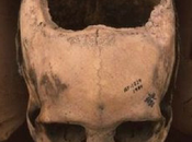 cada pacientes sobrevivían trepanaciones craneanas hechas Incas