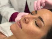 Tratamiento carboxiterapia para ojeras bolsas