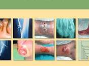 Guía cuidados úlceras extremidades inferiores
