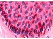 Probablemente estas Infectado Presentas Síntomas