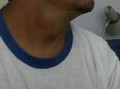 Bocio