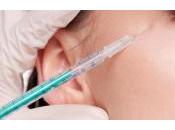 nueva vacuna podría eliminar acné