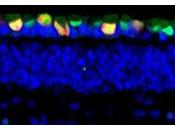 Identifican Etapa Formación Retina puede llevar cáncer
