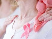 antibiótico puede prevenir recurrencia cáncer mama