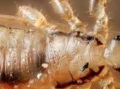 Remedios caseros para eliminar piojos