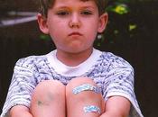 hemorragias principal factor riesgo niños hemofilia