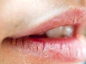 ¿Por quema lengua?