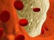 Hipercalcemia: sintomas, tratamentos causas