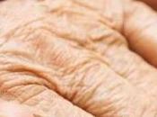 Descubierto tratamiento ralentiza Alzheimer