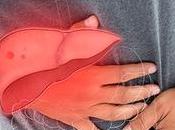 Cómo limpiar hígado