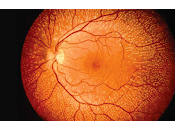 Logran integrar Células Fetales Retina generando Actividad Visual