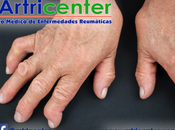 Artricenter: ¿Qué osteoartrosis avanzada?