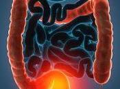 enfermedades inflamatorias intestinales patologías crónicas