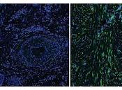 Fibroblastos determinan formas Cicatrización