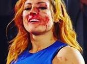 Becky lynch sigue nariz rota sabe luchará