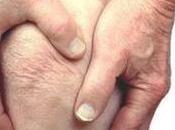 Artricenter: tips para prevenir osteoartritis