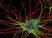 Capacidad Cerebral mejora aumentar número Neuronas
