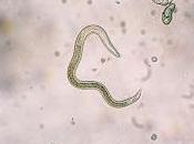 Toxocariasis