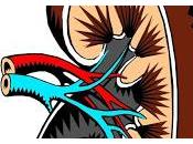 Infecciones Urinarias pueden Enmascarar Cáncer Renal