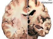 citoesqueleto neuronas está implicado enfermedad Alzheimer.