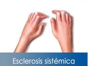 Artricenter: Esclerosis sistémica
