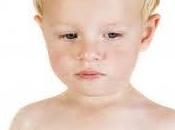 Bronquiolitis