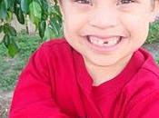 Como alimentar niño Sindrome Down