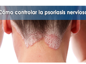 Artricenter: ¿Cómo controlar psoriasis nerviosa?