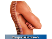Artricenter: Riesgos artrosis vertebral “espondiloartrosis”
