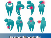 Artricenter: Espondiloartritis