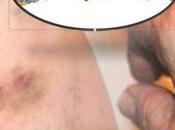Pruebas para leucemia