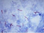 Identifican nuevo objetivo para Tratar Tuberculosis