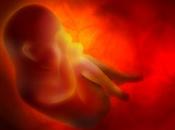 Complicaciones placenta