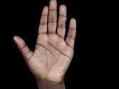 ¿Por personas negras tienen palmas manos pies blancas?