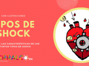 Tipos Shock