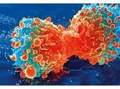 Vinculan Infecciones Microbianas desarrollo Cáncer