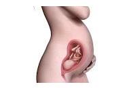 ¿Porque deben usar Macrolidos Embarazo?