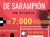 Emergencia ante Epidemia Silenciosa Sarampión Etiopía
