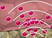 Nanotecnología Cáncer