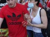 primer herido