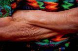 Ante dolor…me cruzo brazos…
