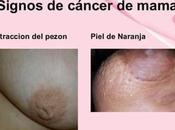 Cancer mama