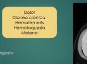 Enteritis sdr. zollinger-ellison