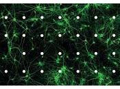 canales calcio juegan papel importante trastornos Autistas