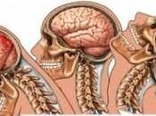 ¿Qué ocurre latigazo cervical?